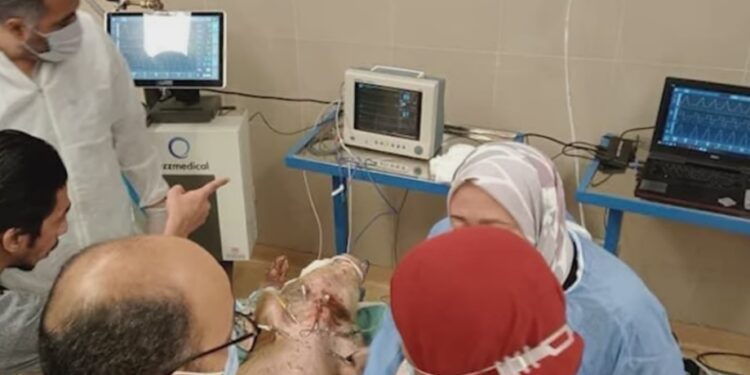 “مركز معلومات الوزراء” يكشف تفاصيل أول جهاز تنفّس صناعي مصري محلي الصنع بالكامل