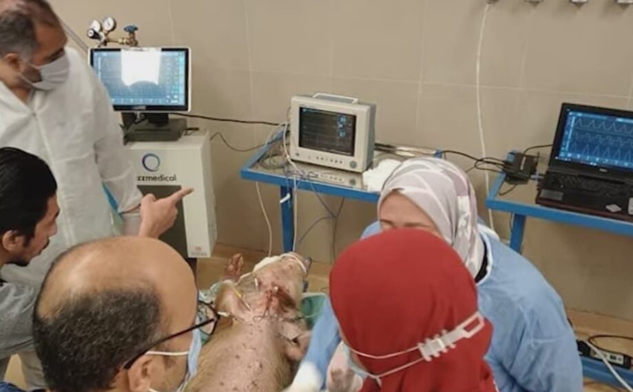 “مركز معلومات الوزراء” يكشف تفاصيل أول جهاز تنفّس صناعي مصري محلي الصنع بالكامل