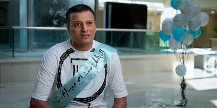 مستشفى أهل مصر تنقذ حياة مريض في حالة حرجة للغاية باستخدام زراعة الجلد الطبيعي